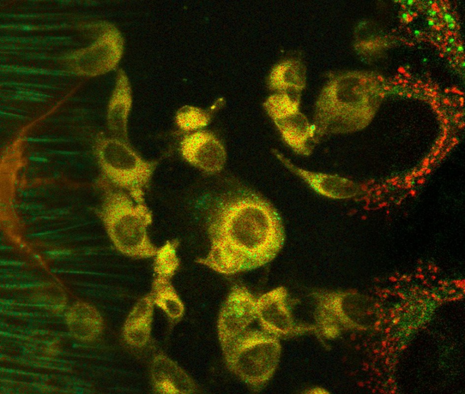 Desenvolvimento de novo método para a deteção de lípidos em células vivas Desenvolvimento de novo método para a deteção de lípidos em células vivas